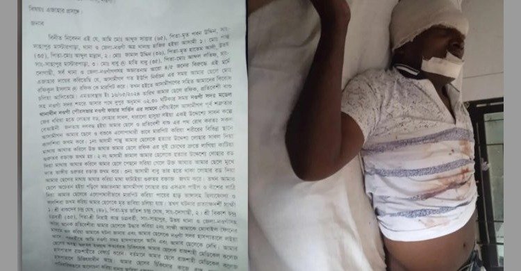 নওগাঁয় প্রতিপক্ষের  হামলার শিকার রফিকুল ইসলাম রফিক গুরুতর আহত অবস্থায় হাসপাতালে ভর্তি