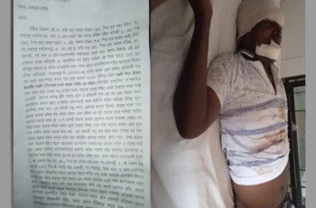 নওগাঁয় প্রতিপক্ষের  হামলার শিকার রফিকুল ইসলাম রফিক গুরুতর আহত অবস্থায় হাসপাতালে ভর্তি