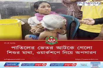 পাতিলের ভেতর আটকে গেলো শিশুর মাথা, ওয়ার্কশপে নিয়ে অপসারণ
